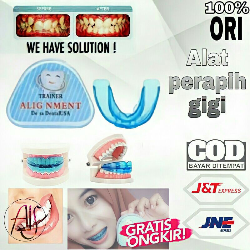 Jual ALAT PERAPIH DAN PERATA GIGI ORTHODONTIC TEETH TRAINER ALIGMENT