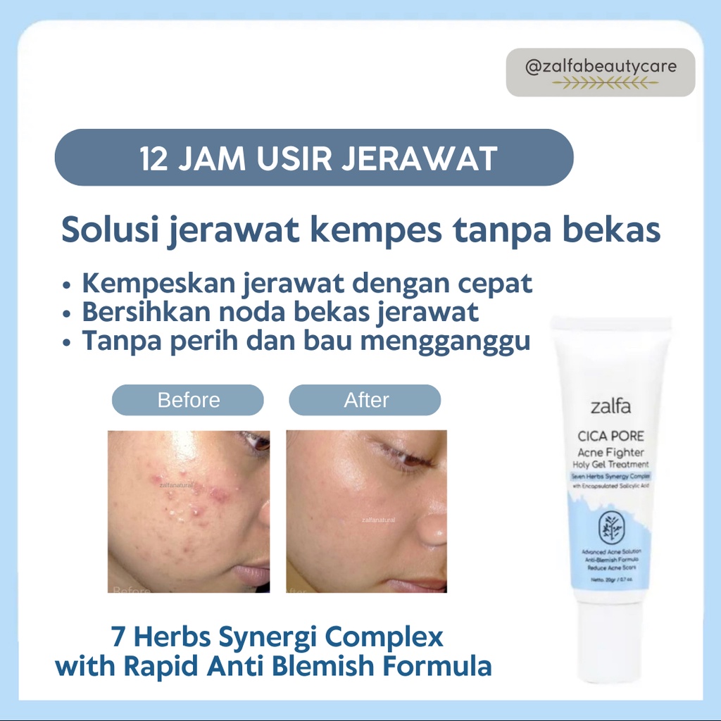 Jual Solusi Jerawat Kempes Zalfa Natural Cica Pore Acne Fighter Acne