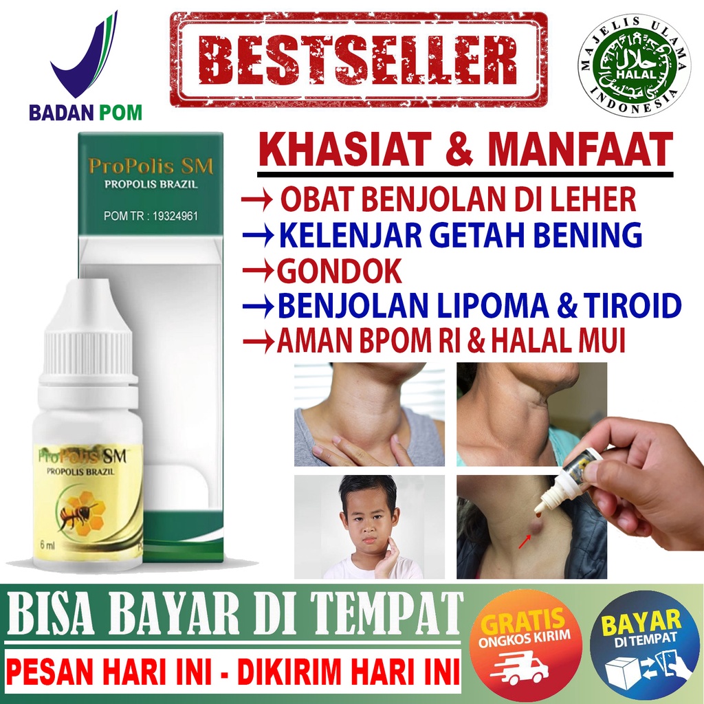 Jual Obat Antibiotik Benjolan Di Leher Kelenjar Getah Bening Gondok