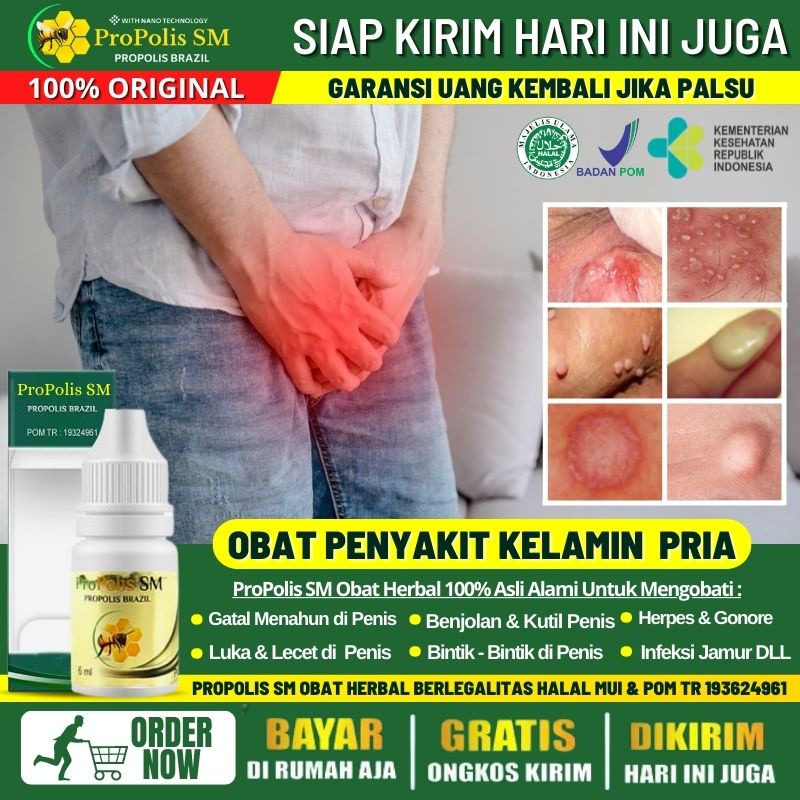 Jual Obat Balanitis Herbal Alami Obat Gatal Di Kepala Penis