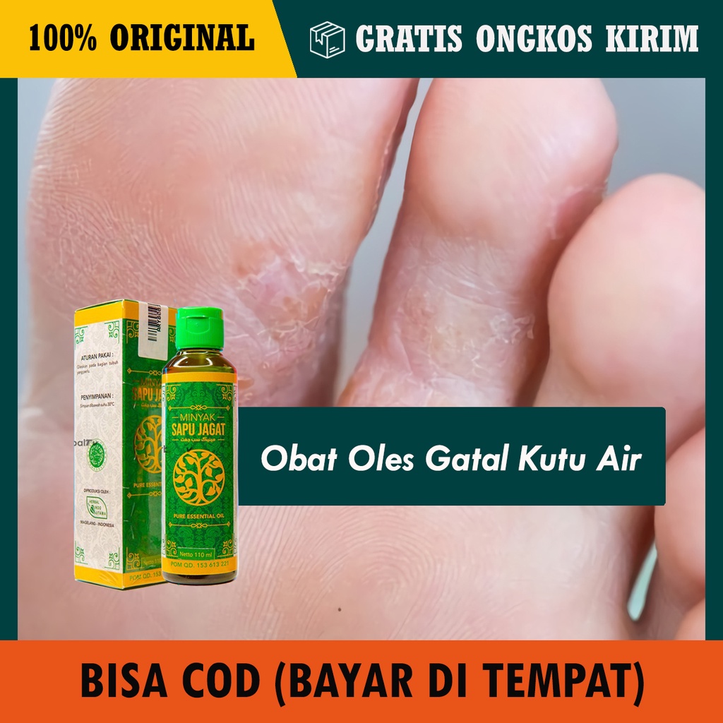 Jual COD Obat Kutu Air Di Tangan Di Sela Jari Obat Kutu Air