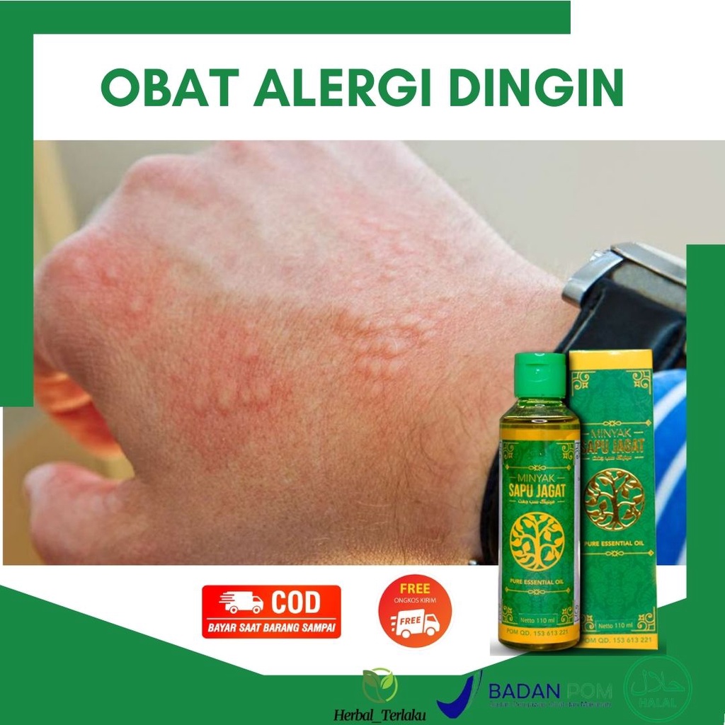 Jual Obat Alergi Dingin Tradisional Bentol Bentol Ruam Merah Di