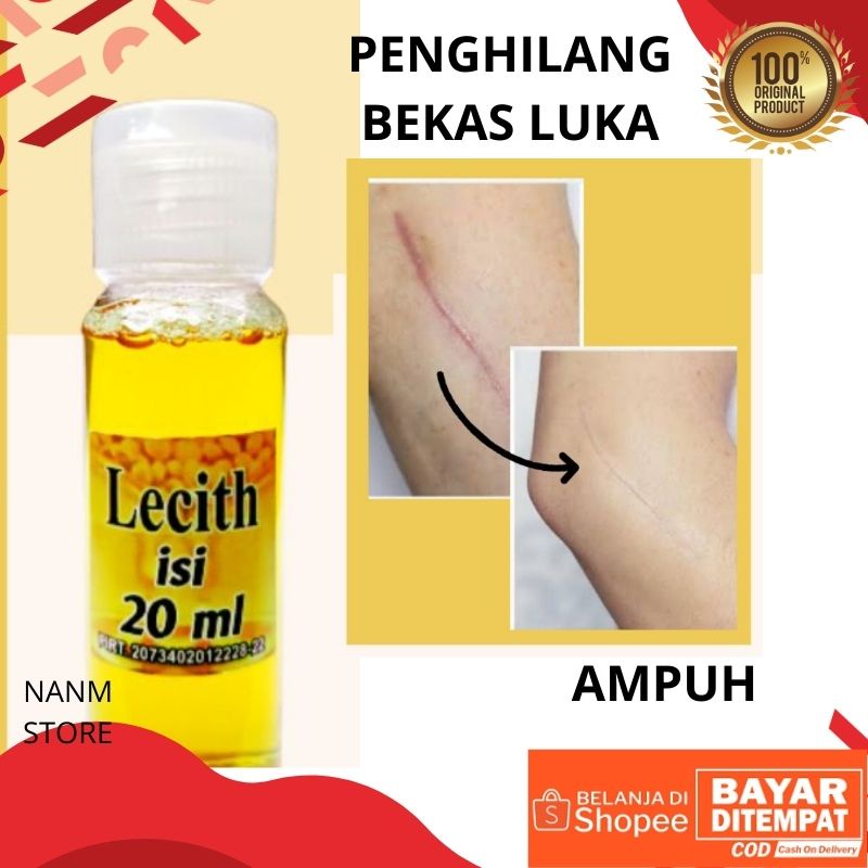 Jual Lecith Ml Original Obat Penghilang Bekas Luka Untuk Keloid