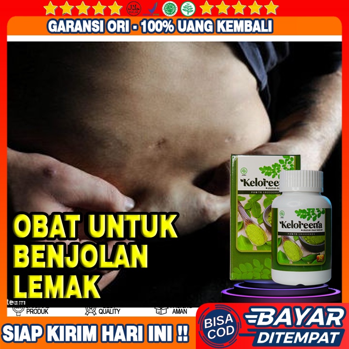 Jual Obat Benjolan Lemak Benjolan Di Leher Lipoma Uci Uci Tumor