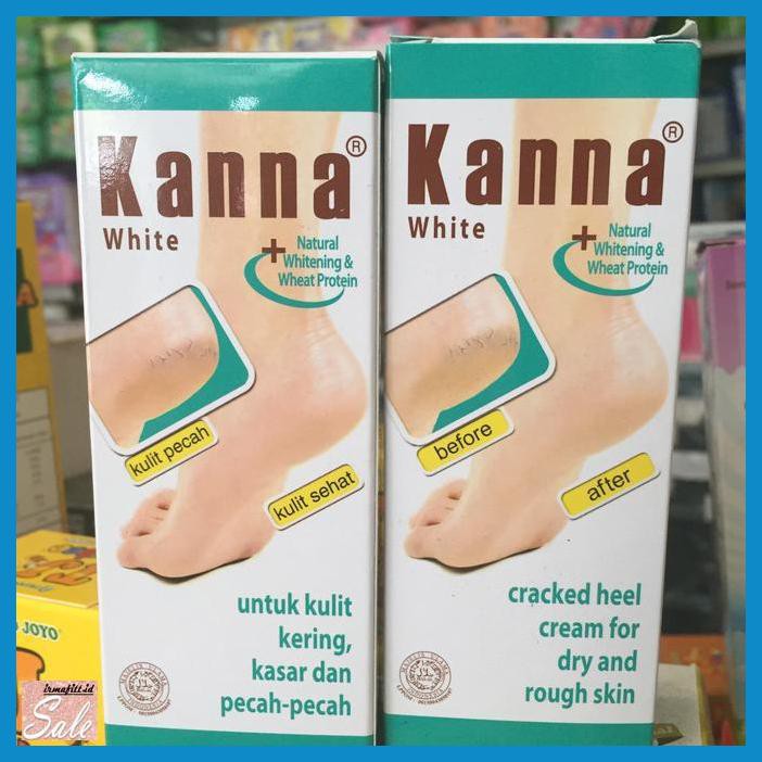 Jual Creamhand Kanna Krim Lembut 30gr Obat Krim Kulit Kering Kasar