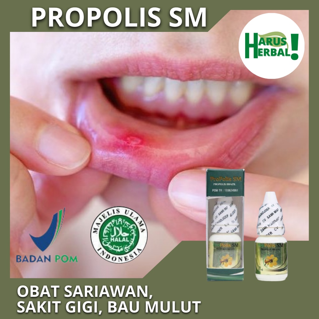 Jual Obat Sariawan Alami Obat Herbal Sariawan Di Bibir Obat Sariawan