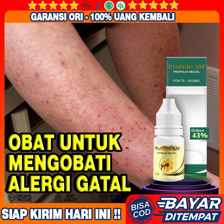 Jual Obat Gatal Alergi Gatal Berair Gatal Biduran Gatal Bentol