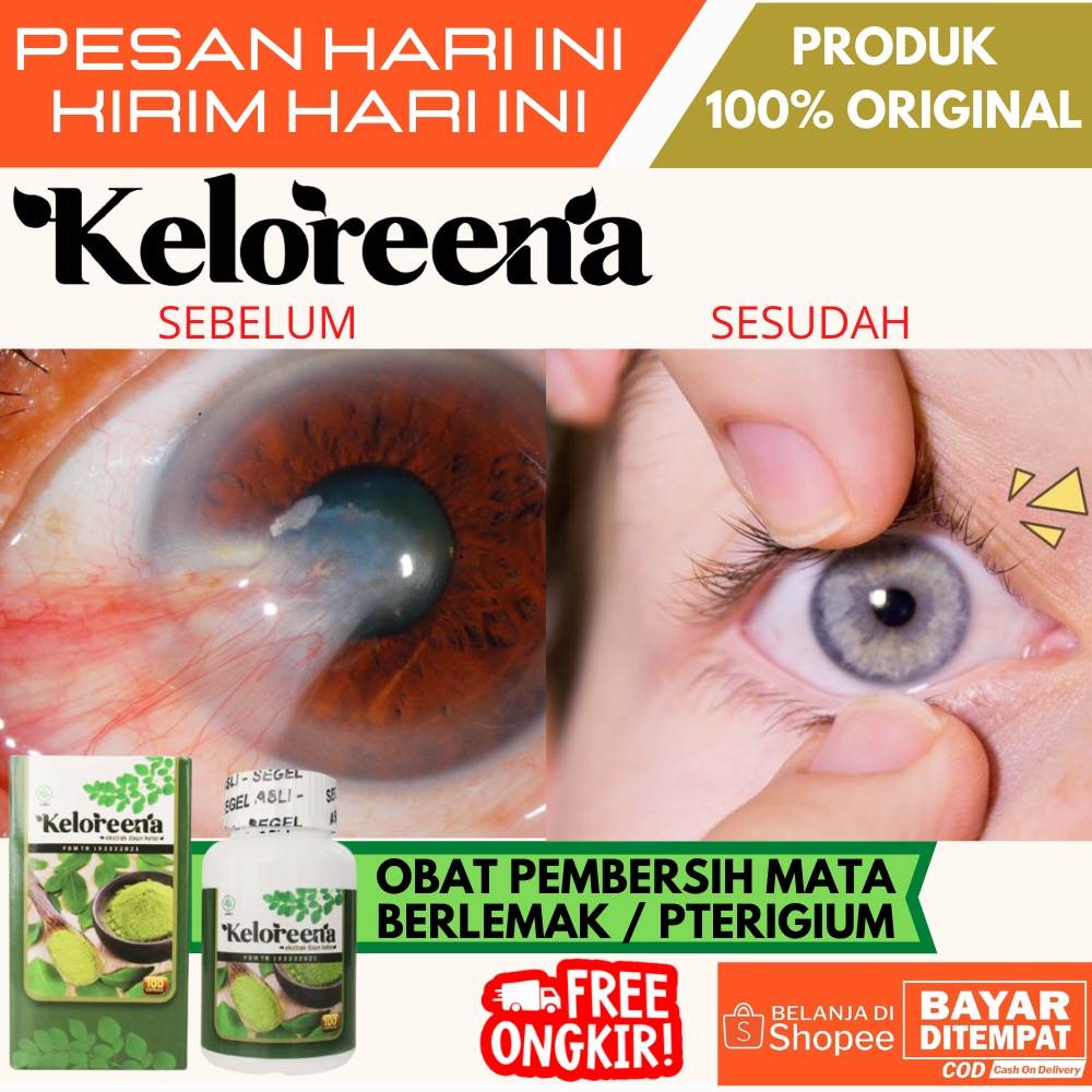 Jual Obat Mata Berlemak Mata Lamadan Pterygium Obat Pembersih