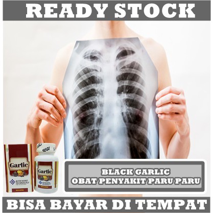 Jual Obat Paru Paru Kering Basah Obat Tradisional Inflamasi Kronis