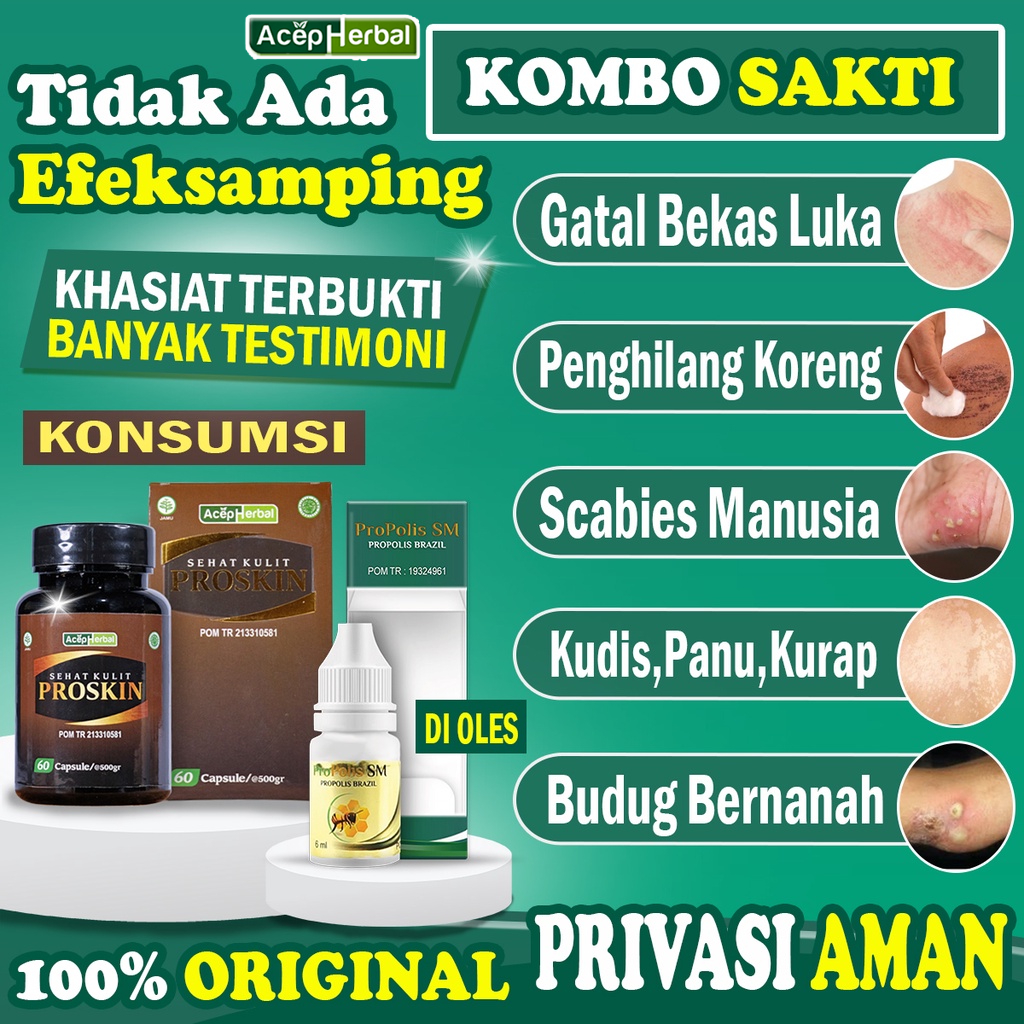 Jual Obat Gatal Kulit Untuk Bekas Luka Korengan Budugan Kudis Gudikan