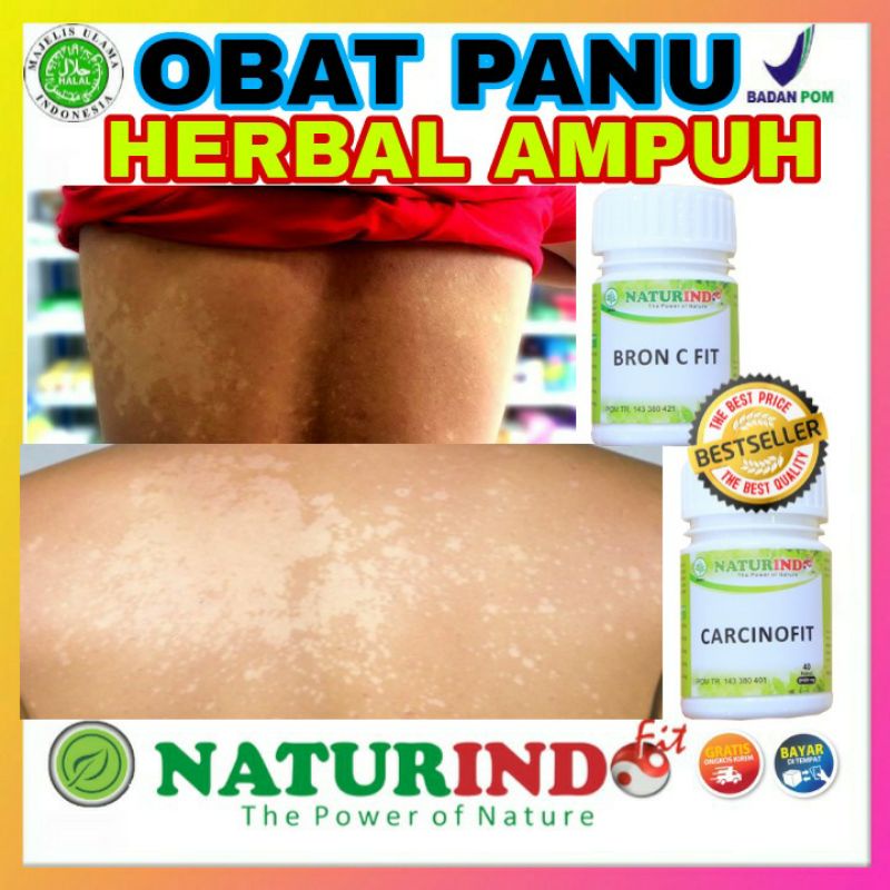 Jual Obat Panu Kadas Kudis Kurap Kutu Air Herpes Exsim Kering Basah