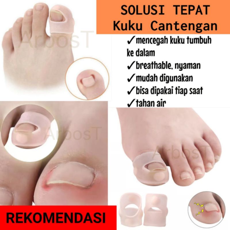 Jual Alat Koreksi Kuku Kaki Tumbuh Ke Dalam Silikon Elastis Cantengan