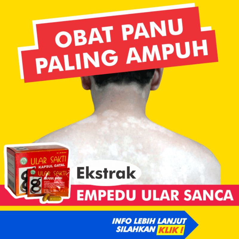 Jual Obat Panu Paling Ampuh Gatal Kulit Kurap Kutu Air Jamur