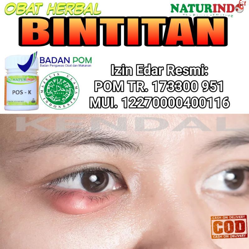 Jual Obat Bintitan Herbal Ampuh Kalazion Benjolan Di Kelopak Mata