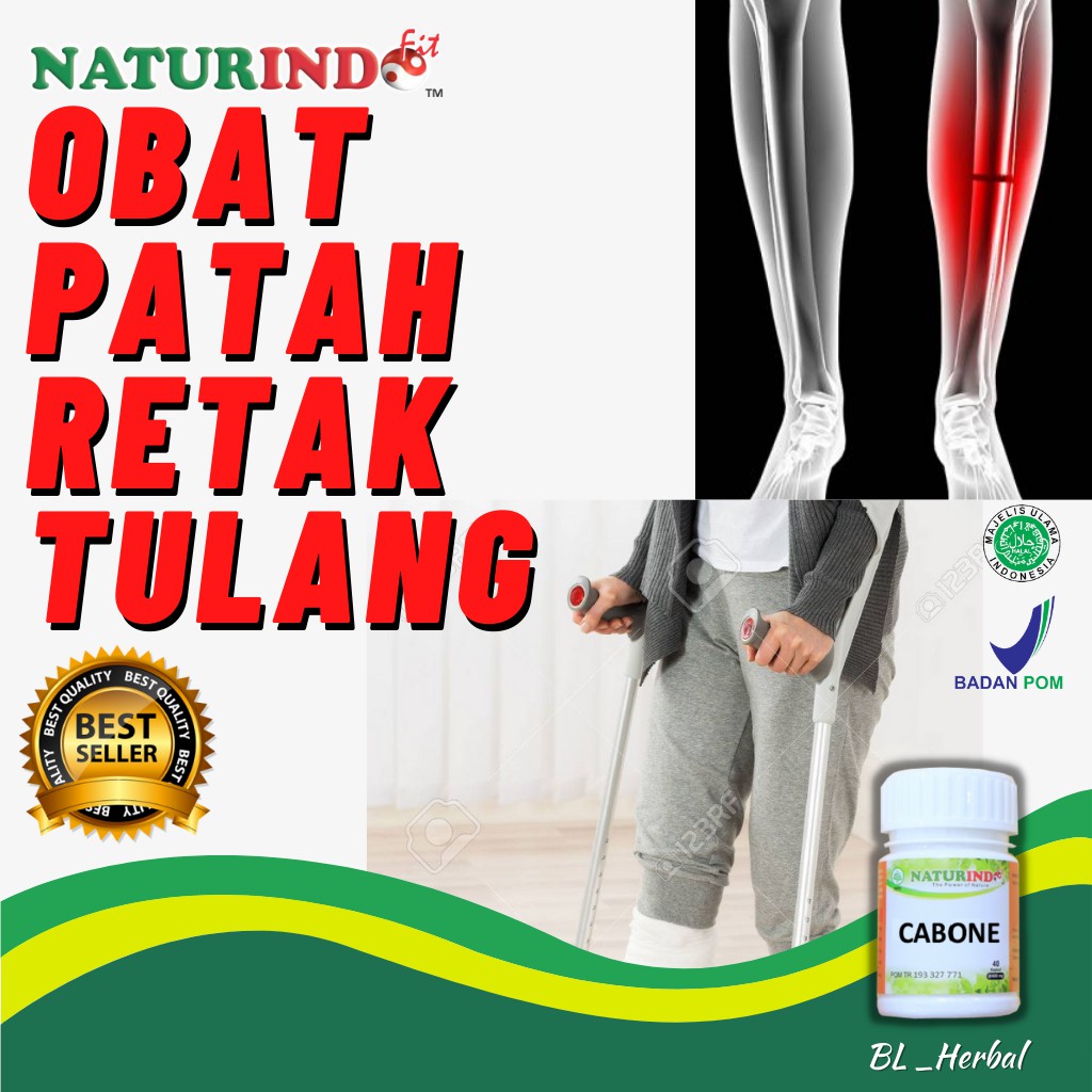 Jual Obat Patah Tulang Dan Retak Herbal Ampuh Penyambung Perekat Tulang