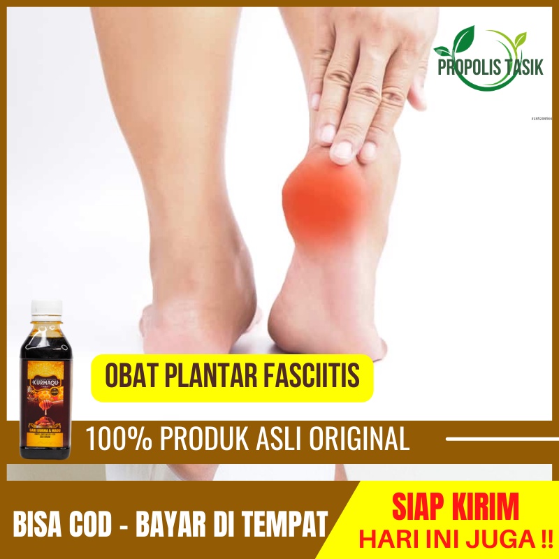 Jual Obat Plantar Fascia Nyeri Tumit Kaki Asam Urat Kaki Bengkak