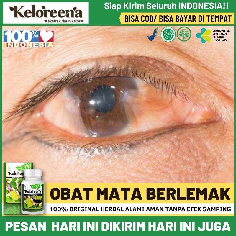 Jual Obat Mata Berlemak Penghilang Lamad Pada Selaput Putih Mata