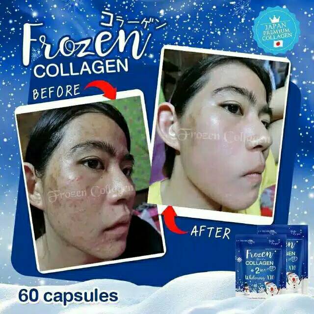 Jual Frozen Collagen 2in1 Whitening X10 Original Thailand Original