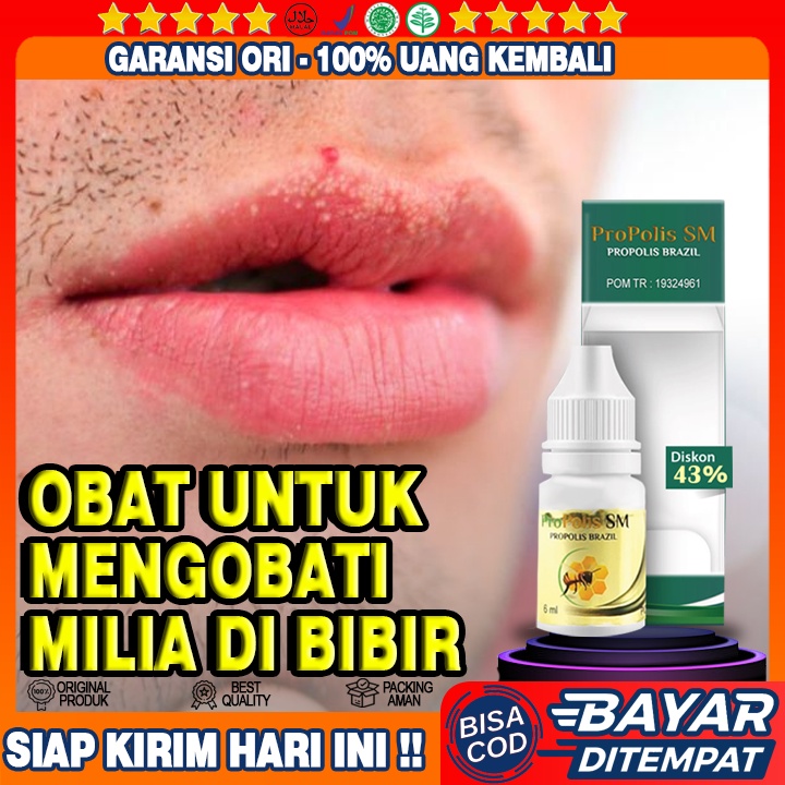 Jual Obat Milia Di Bibir Milia Di Hidung Milia Pada Wajah Milia Di