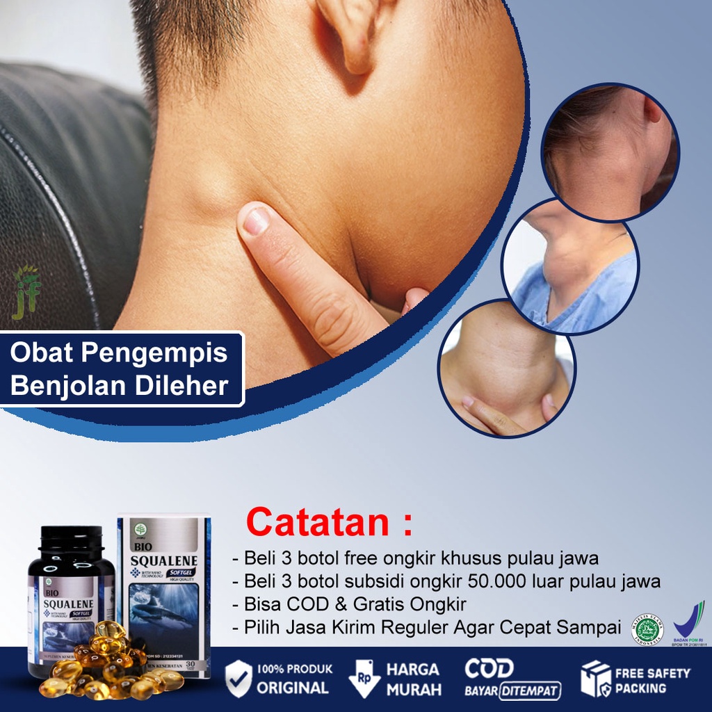 Jual Obat Pengempis Benjolan Di Leher Tiroid Kelenjar Getah Bening