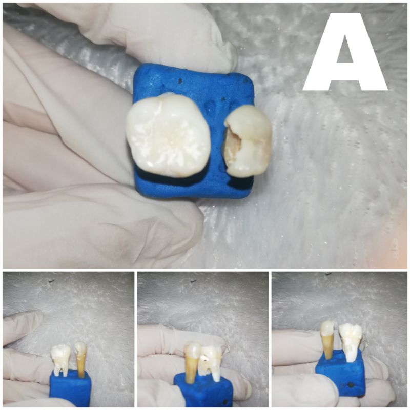 Jual Gigi Insisivus Premolar Molar Praktikum Shopee Indonesia