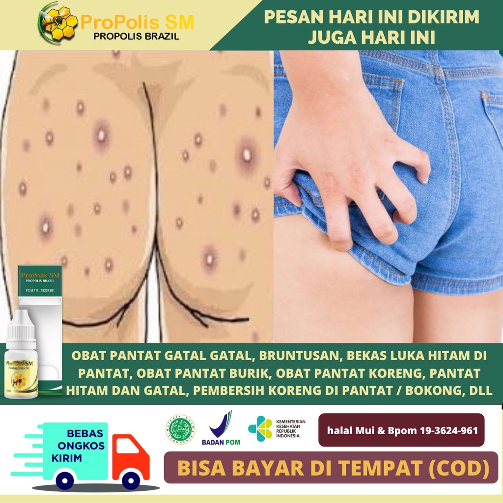 Jual Obat Pantat Gatal Gatal Bruntusan Bekas Luka Hitam Di Pantat