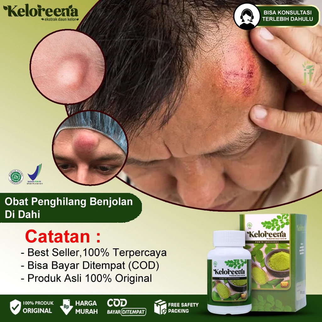 Jual Obat Penghilang Benjolan Di Dahi Kelenjar Getah Bening Tiroid