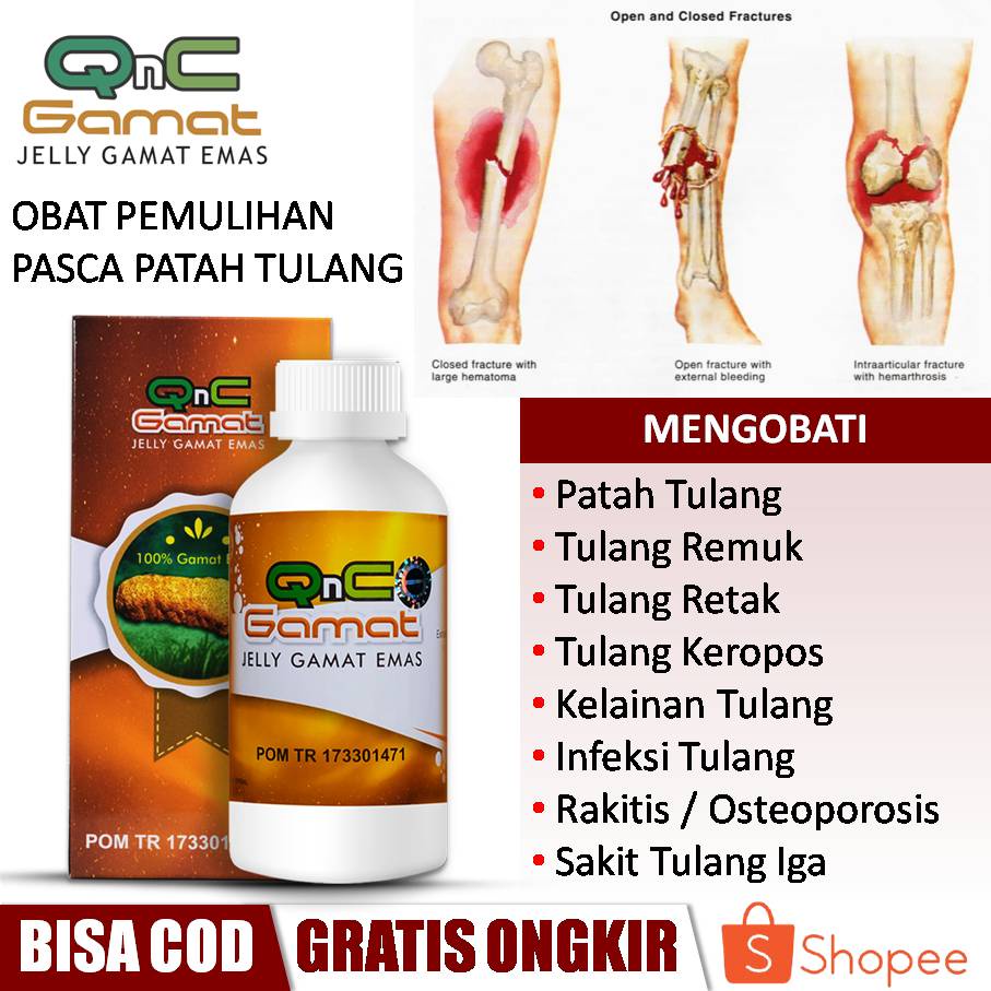 Jual QNC Jelly Gamat 100 Herbal Alami Obat Tulang Keropos Tulang