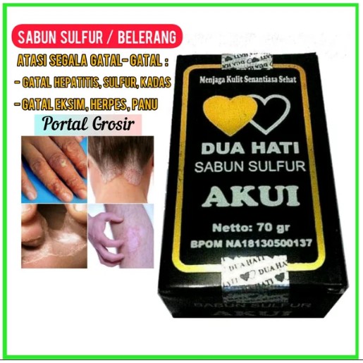 Jual SABUN Sulfur Akui BELERANG Obat Gatal Kulit Exsim Eksim Menahun