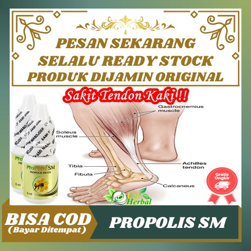 Jual Propolis Sm Obat Sakit Tendon Kaki Sakit Tendinitis Achilles