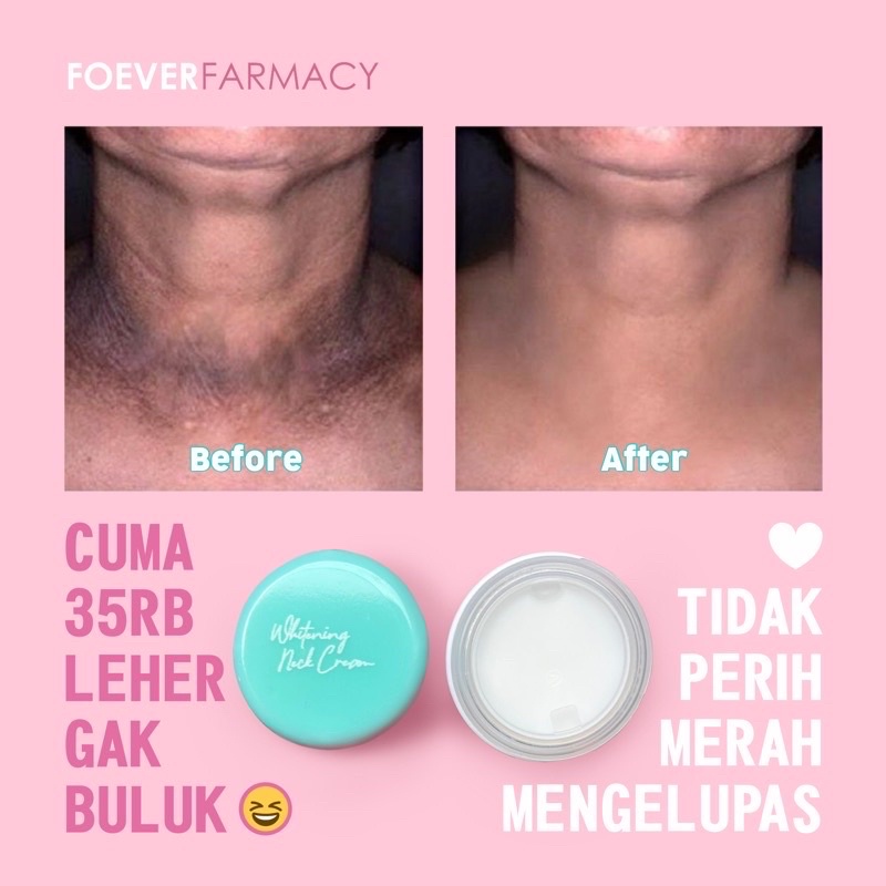 Jual Xudy Cream Lipatan Selangkangan Ketiak Bikini Line Cream