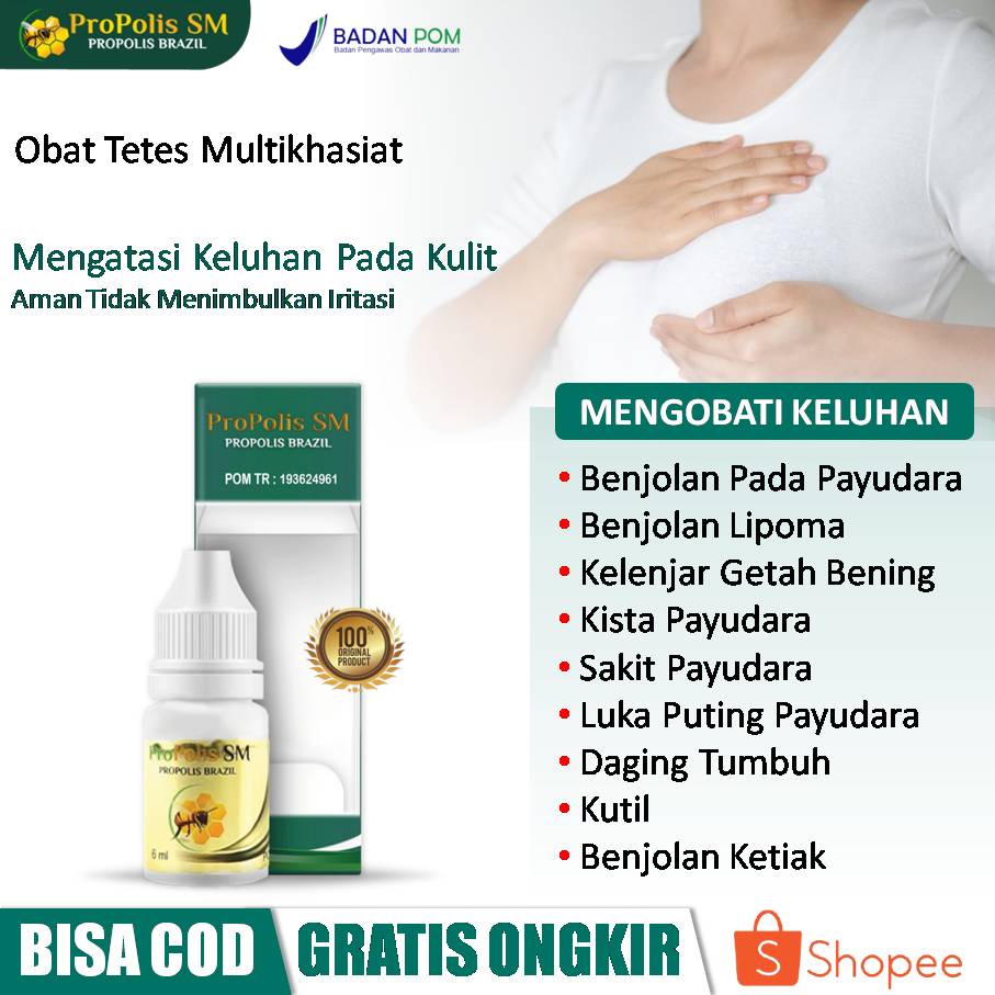 Jual Obat Oles Benjolan Benjolan Di Payudara Benjolan Lemak Lipoma