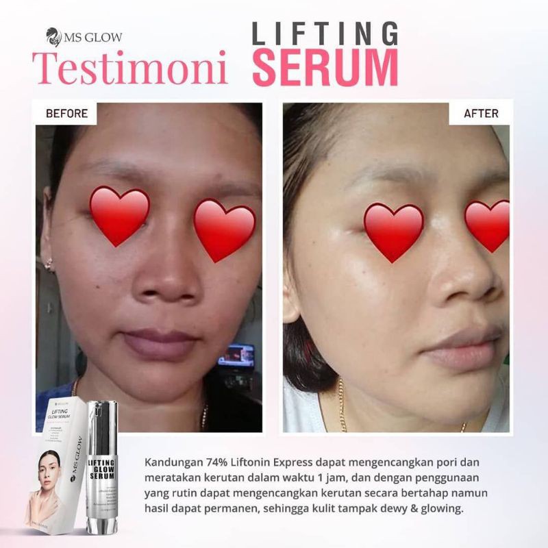 Jual Lifting Serum Ms Glow Shopee Indonesia