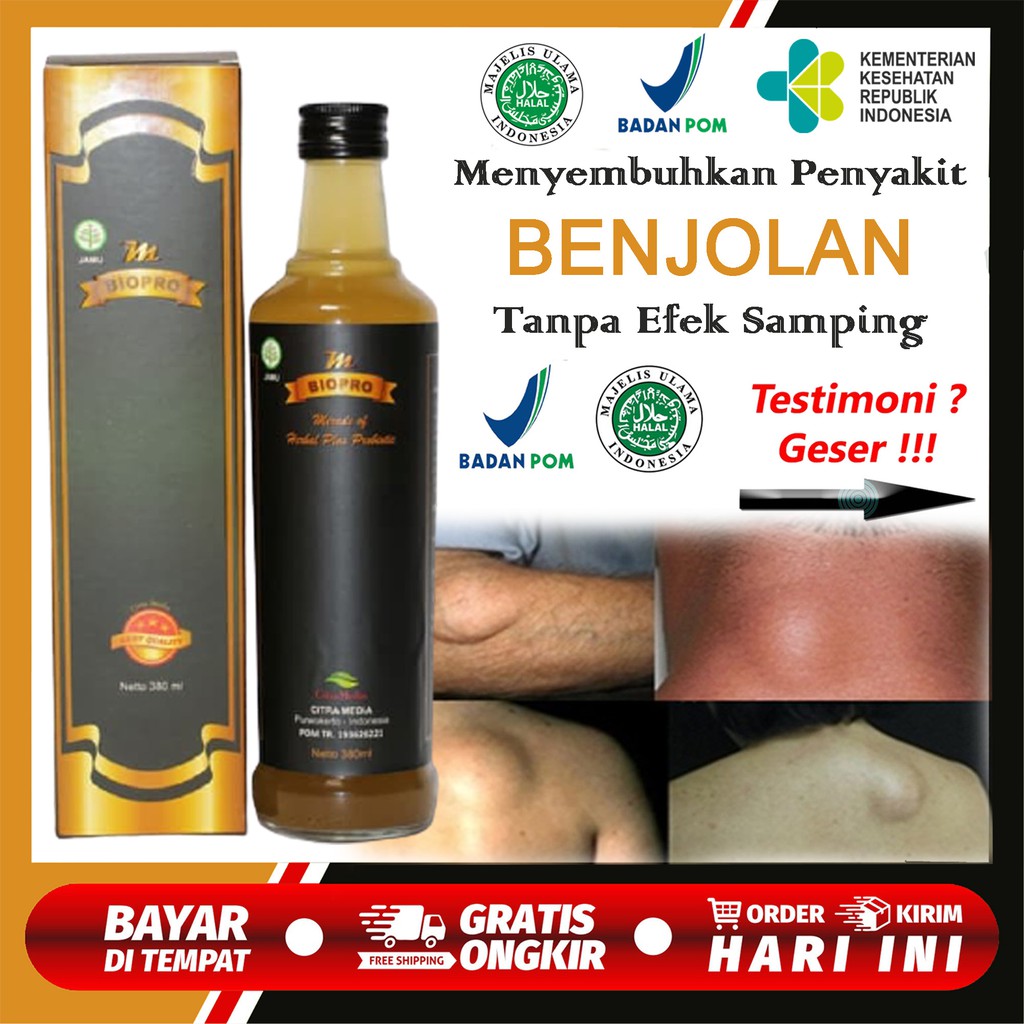 Jual Mbiopro Obat Benjolan Payudara Obat Benjolan Di Ketiak Punggung