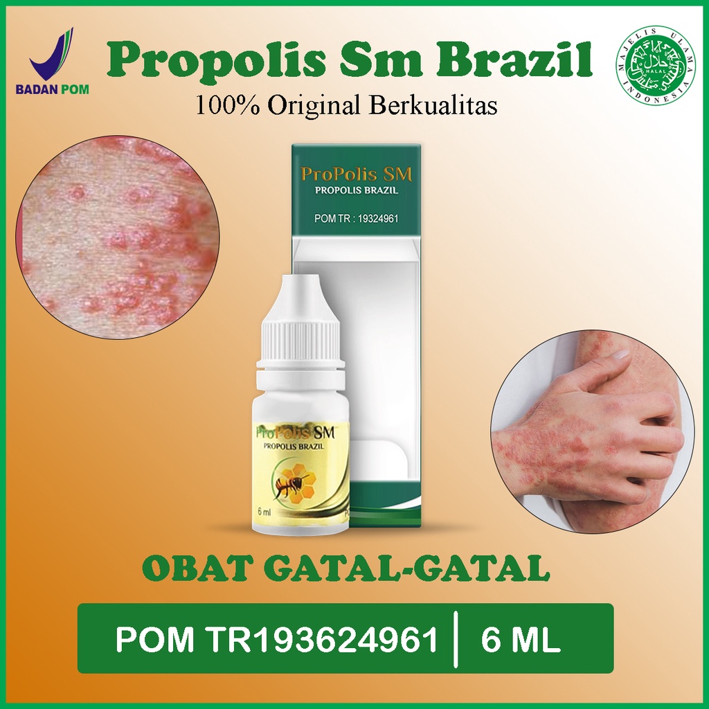 Jual Propolis SM Obat Gatal Gatal Eksim Kering Basah Kurap Kadas Panu