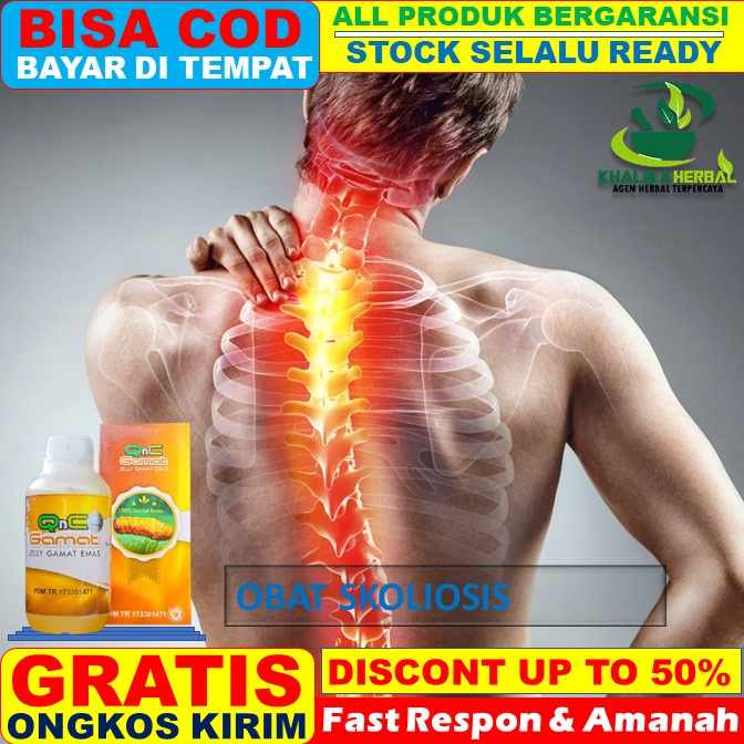 Jual Obat Skoliosis Obat Skoliosis Tulang Bengkok Gangguan Tulang