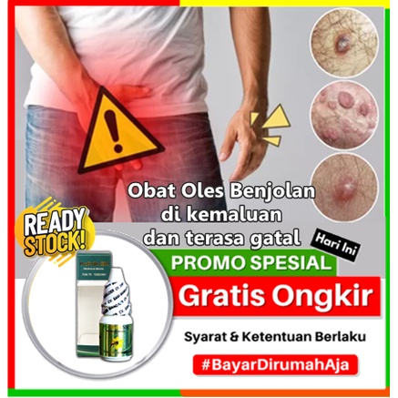 Jual Obat Folikulitis Obat Oles Benjolan Di Kemaluan Dan Terasa Gatal