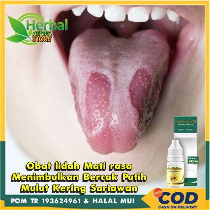 Jual Obat Lidah Mati Rasa Dan Menimbulkan Bercak Putih Mulut Kering