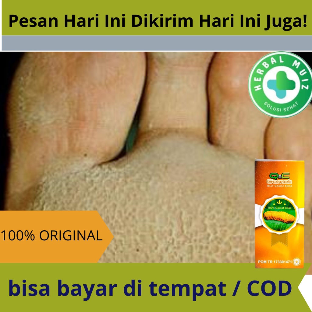 Jual Obat Herbal Kaki Rayapan Pitted Keratolysis Telapak Kaki