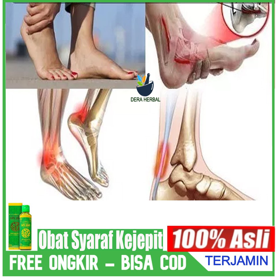 Jual Obat Oles Untuk Atasi Syaraf Kejepit Saraf Kejepit Di Kaki Leher