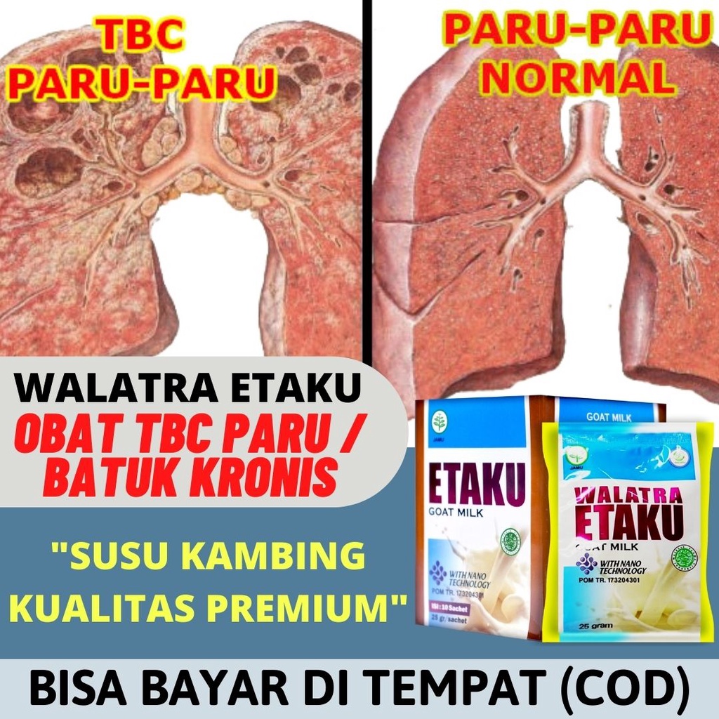 Jual Etaku Obat Tbc Tuberkulosis Radang Paru Paru Basah Bronkitis Batuk