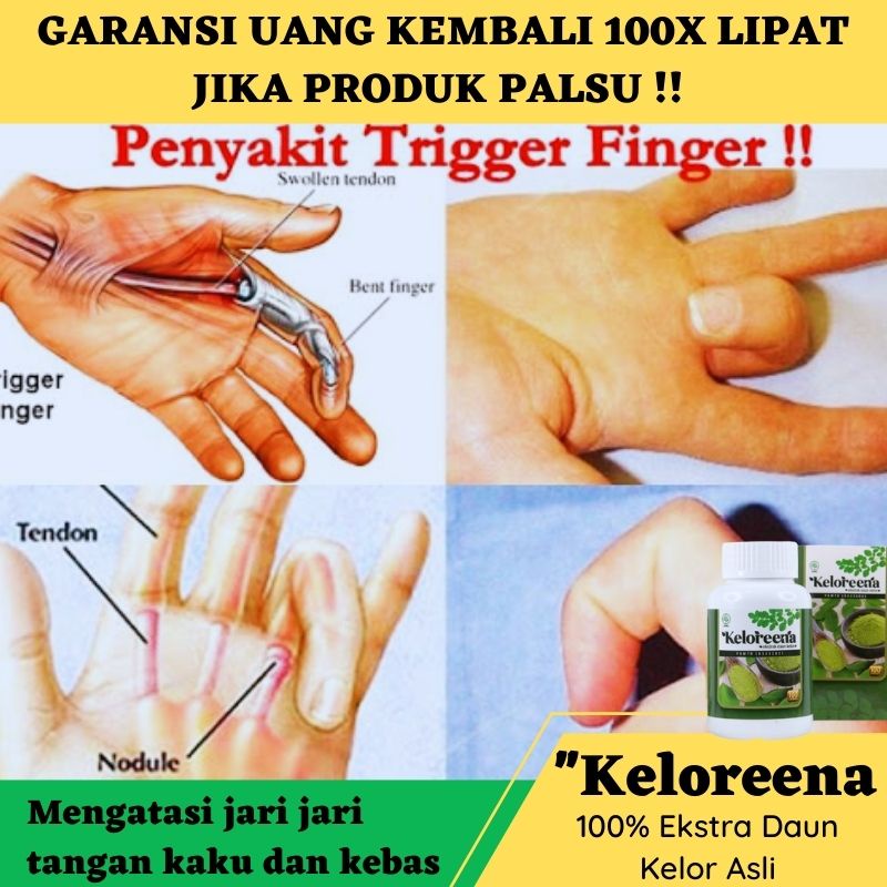 Jual Obat Jari Tangan Kaku Kebas Linu Tringer Finger Sering Kesemutan