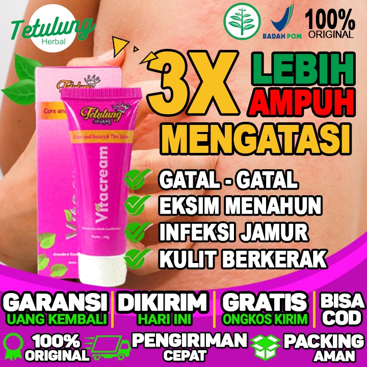 Jual Obat Gatal Gatel Paling Ampuh Kulit Eksim Exim Kering Basah