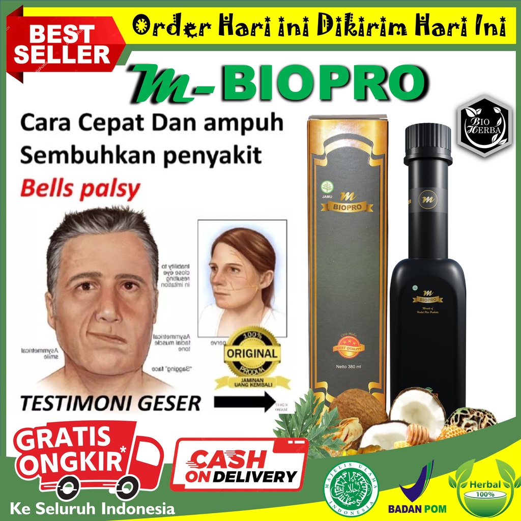 Jual Obat Bells Palsy Bell Palsy Belpalsi Wajah Kaku Sebelah Lumpuh