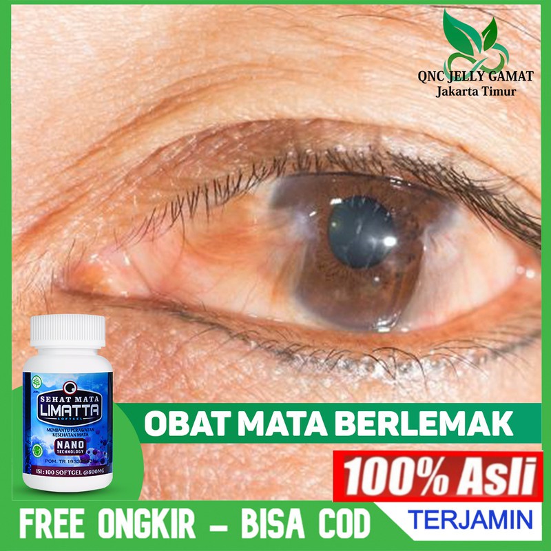 Jual Obat Mata Berlemak Glukoma Pterigium Gumpalan Lemak Pada Mata