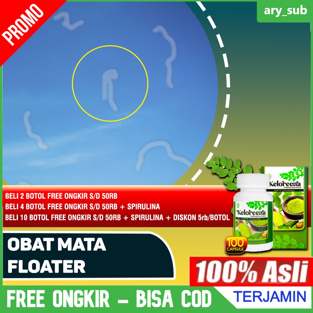 Jual Obat Mata Floater Floaters Ablasi Retina Eye Floaters Bintik