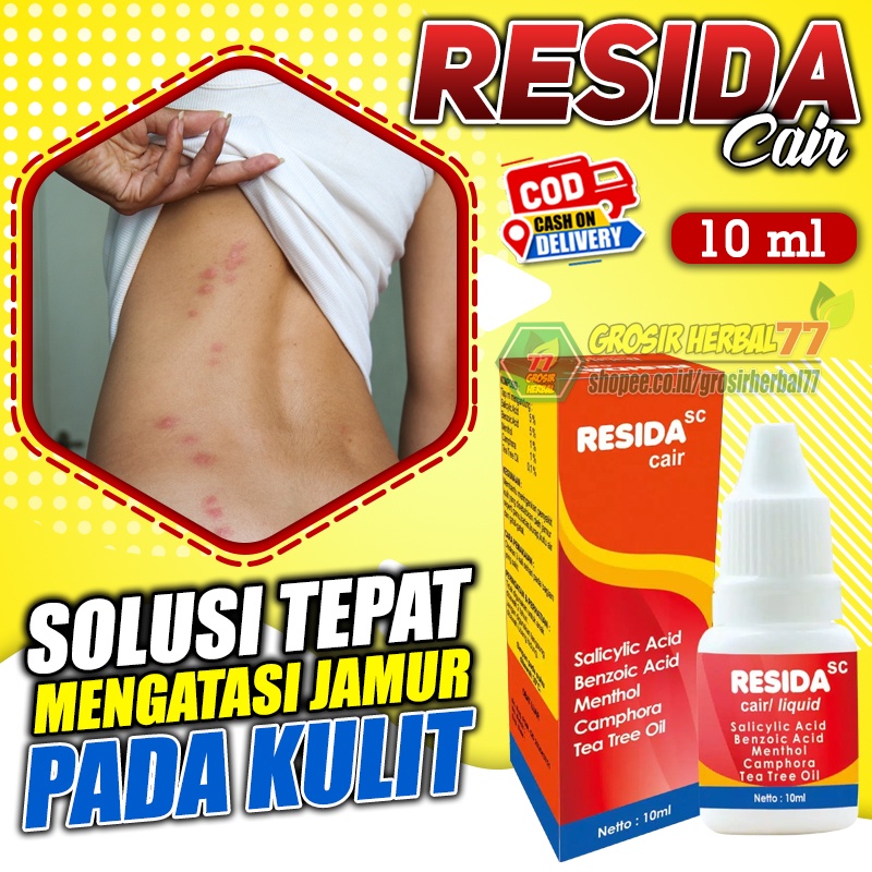 Jual Resida Cair Obat Panu Kadas Kurap Kutu Air Gatal Gatal