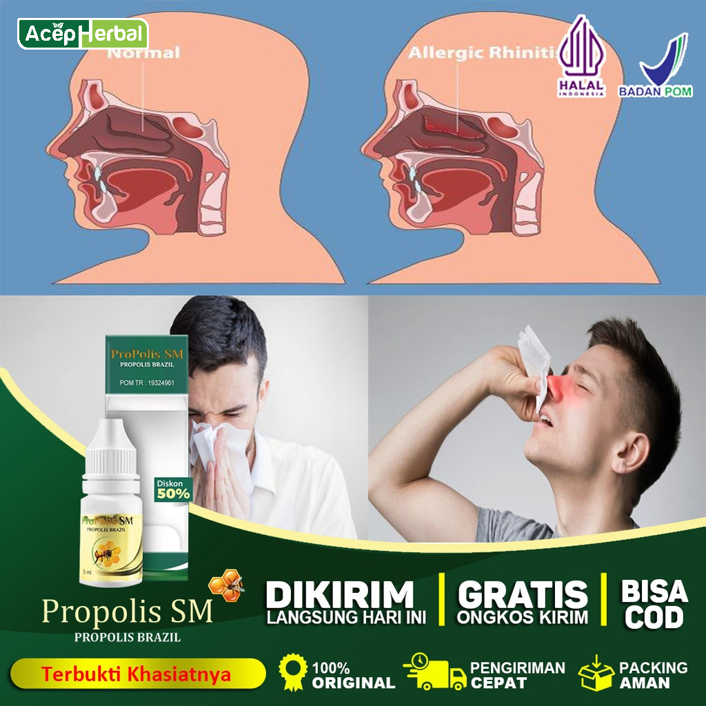 Jual Obat Anosmia Hilang Penciuman Rhinitis Alergi Hidung Tersumbat