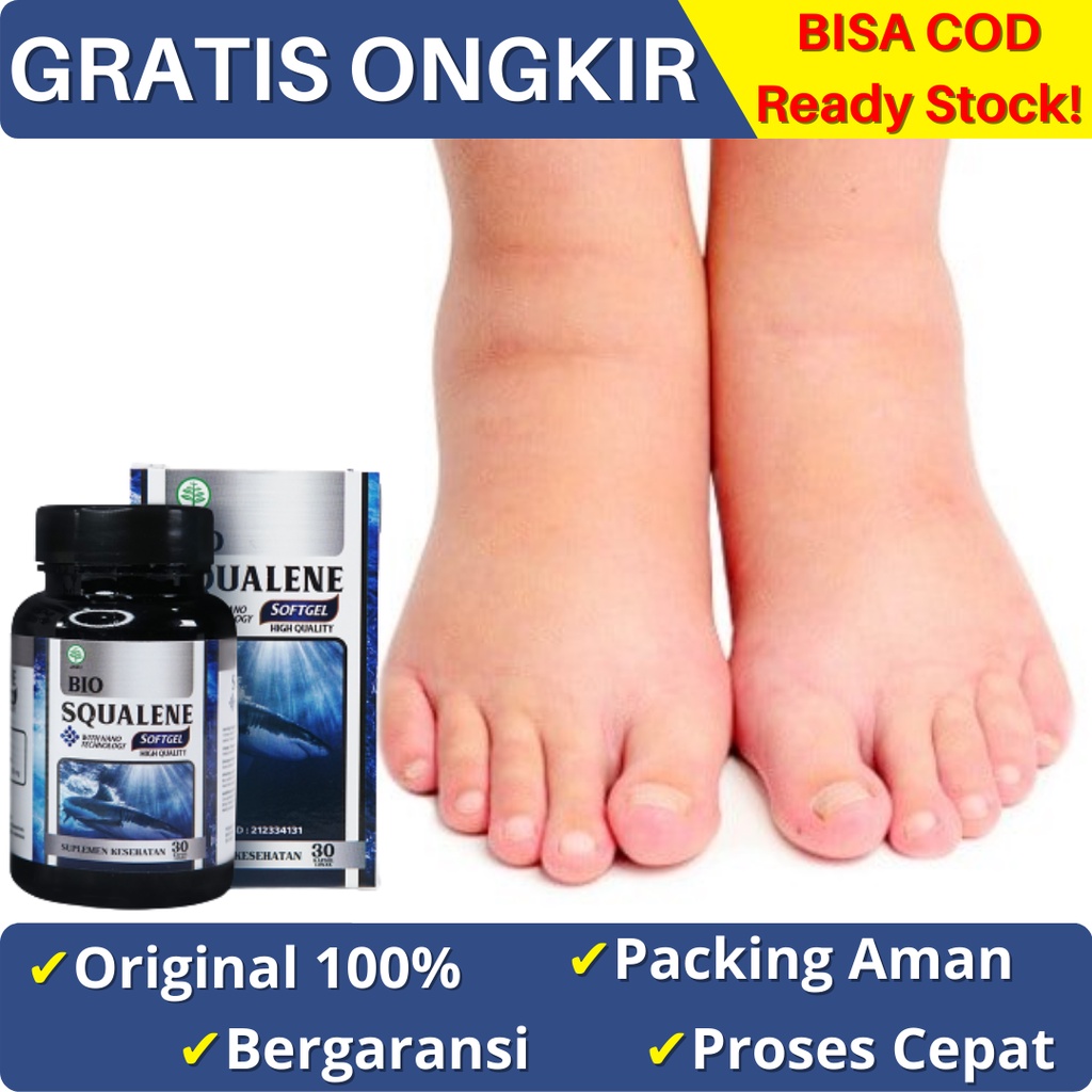 Jual Obat Kaki Bengkak Penderita Diabetes Edema Kaki Bengkak Karena