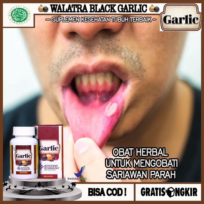 Jual Obat Sariawan Panas Dalam Bibir Pecah Pecah Kering Walatra